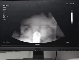 Emergency Dick - Uncut  MEN   Benjamin Blue, Clark Delgaty, Tony D'Angelo, Dane Jaxson    stream full at  www.sexmen.com star gay porn japan old