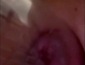 Alikat2 inflates anal lips chinese father and son gay porn