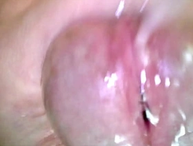 Korslaveman - Sounding with an endoscopic camera gay porn muscle hot